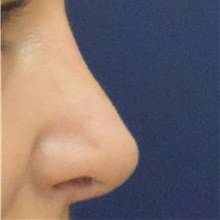after image