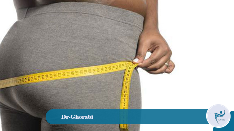 buttock augmentation