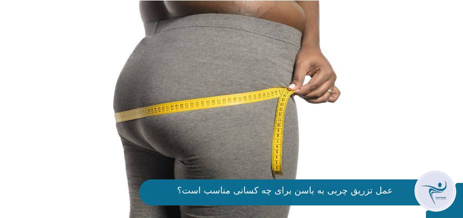 کاندیدای مناسب برای عمل تزریق چربی به باسن