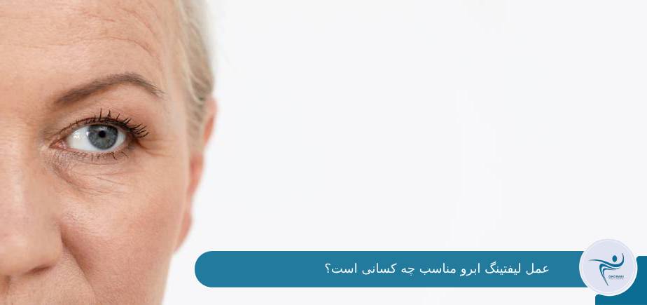 کاندیدای عمل لیفتینگ ابرو 