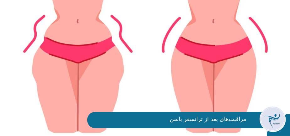مرقبت های عمل جراحی ترانسفر باسن