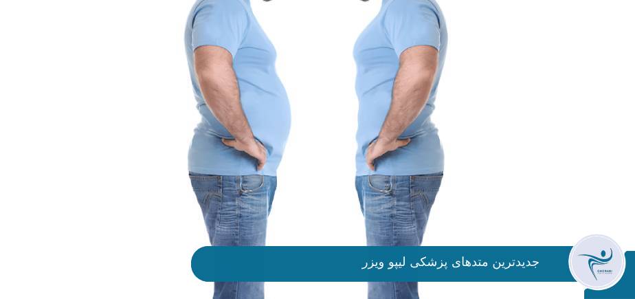 خدمات لیپو ویزر