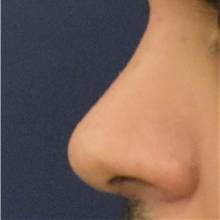after image
