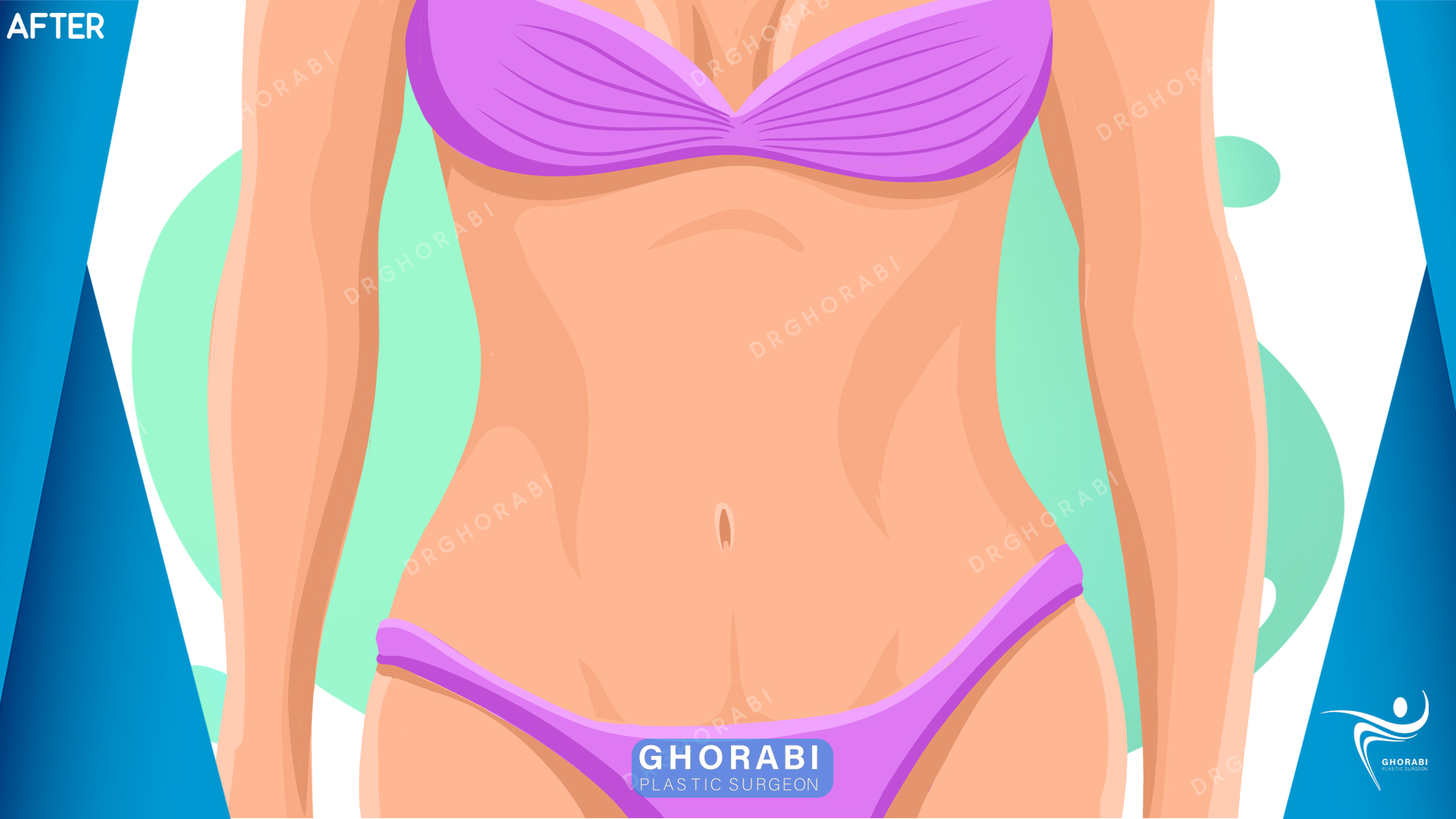 After Image