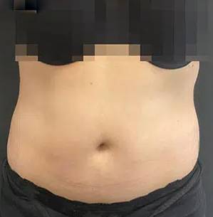 before Image
