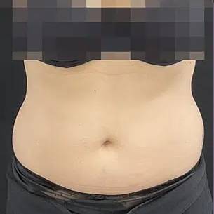 after image
