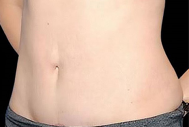 After Image