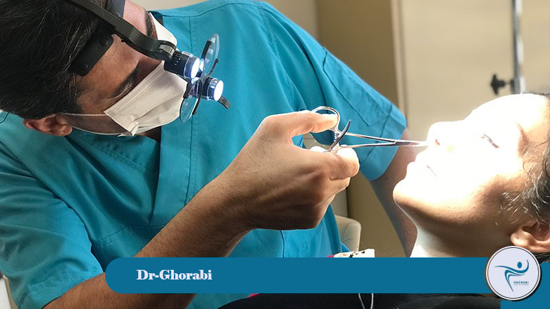 The Right Time for Revision Rhinoplasty