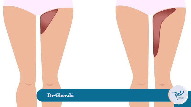 Types of body cosmetic surgery