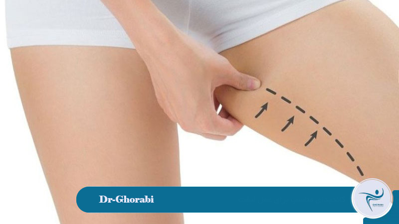 achieve desired and natural results