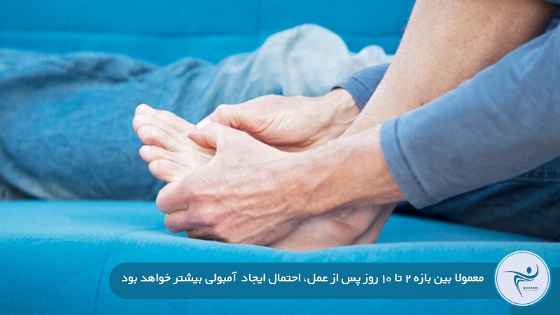 بررسی میزان خطر آمبولی تا چند روز بعد از عمل