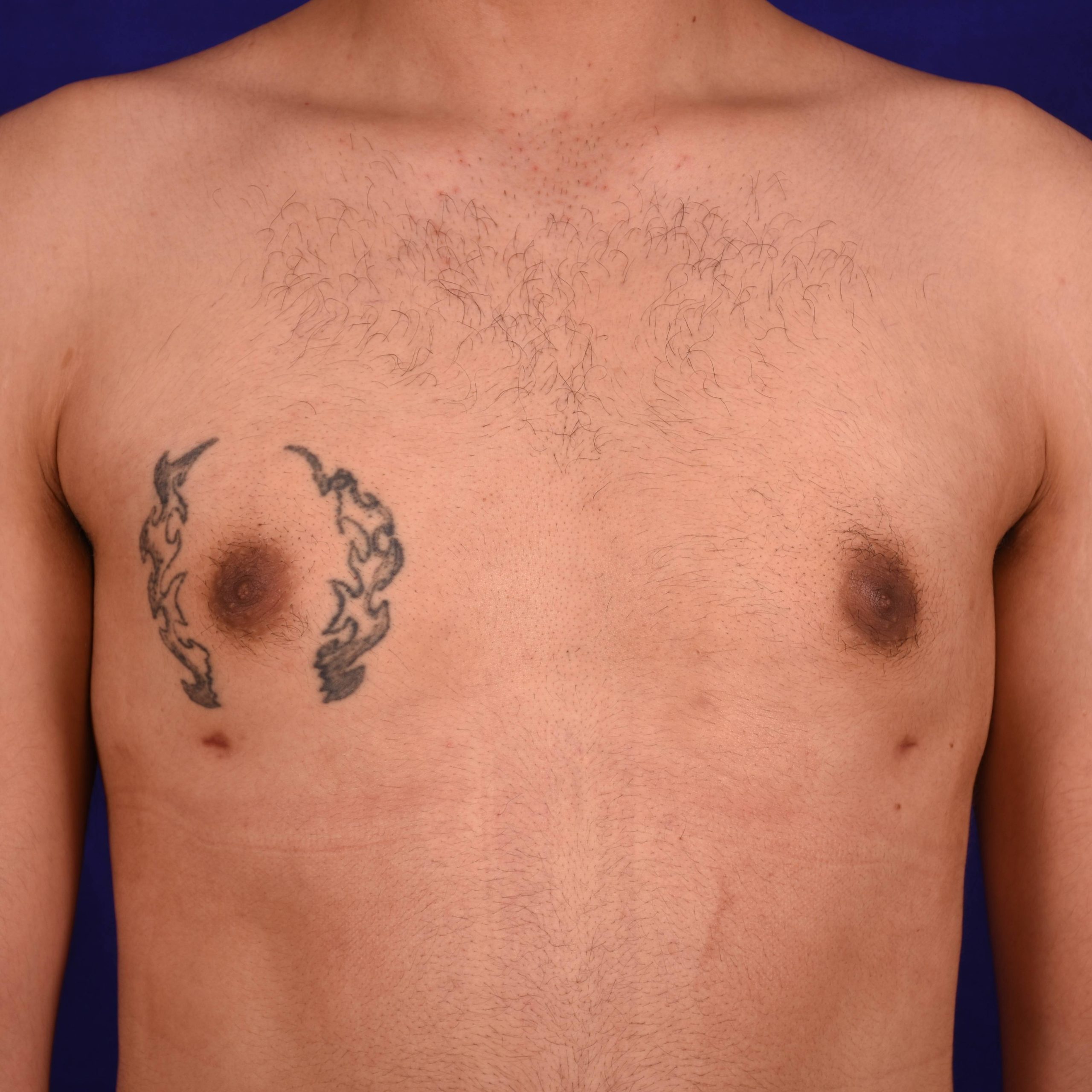 after image