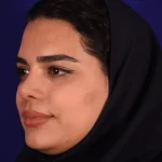 جراحی بینی توسط دکتر غرابی