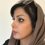 جراحی بینی دکتر غرابی