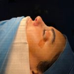 عمل بینی توسط جراحی