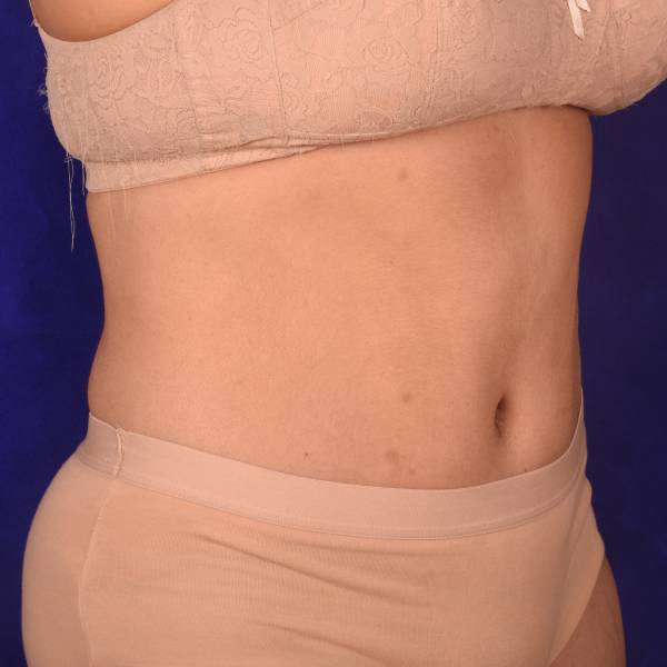 after image