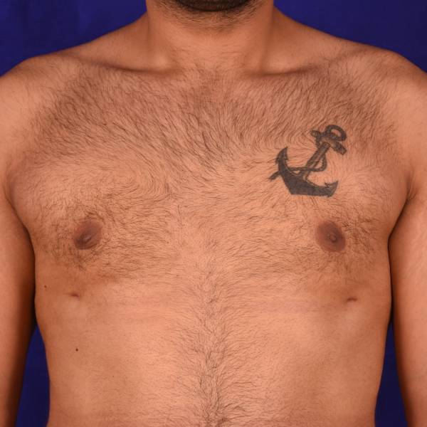 after image