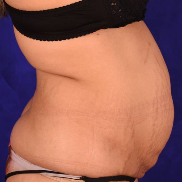before Image