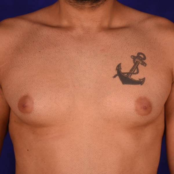 before Image