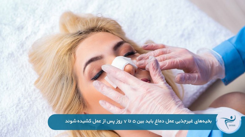 کشیدن بخیه پس از عمل زیبایی بینی