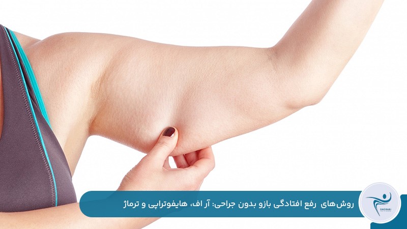  رفع افتادگی بازو بدون جراحی با آر اف، هایفوتراپی و ترماژ