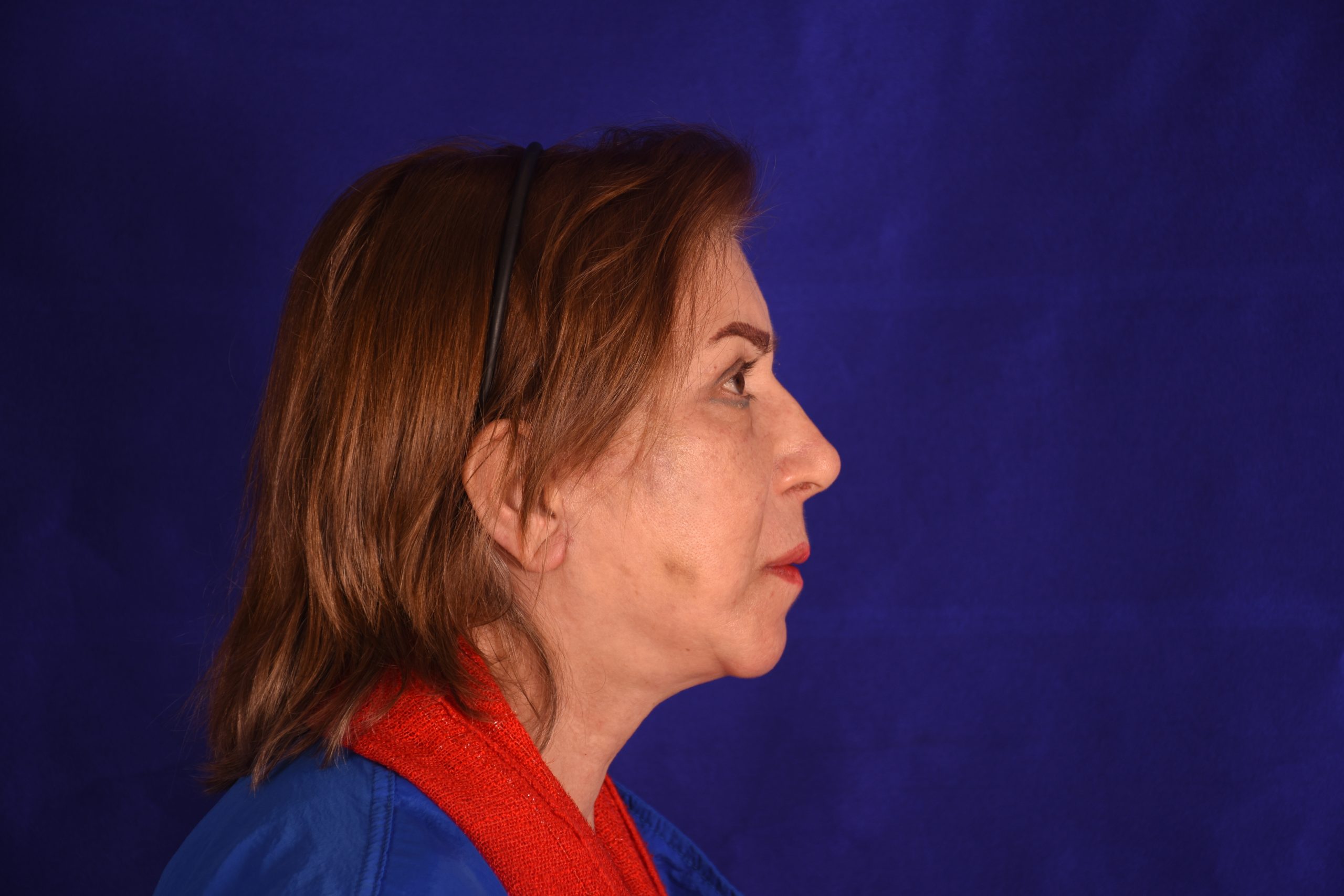 after image