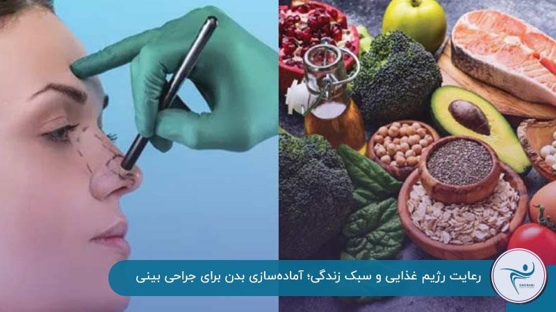 رعایت رژیم غذایی از کارهای که قبل از عمل بینی باید انجام داد