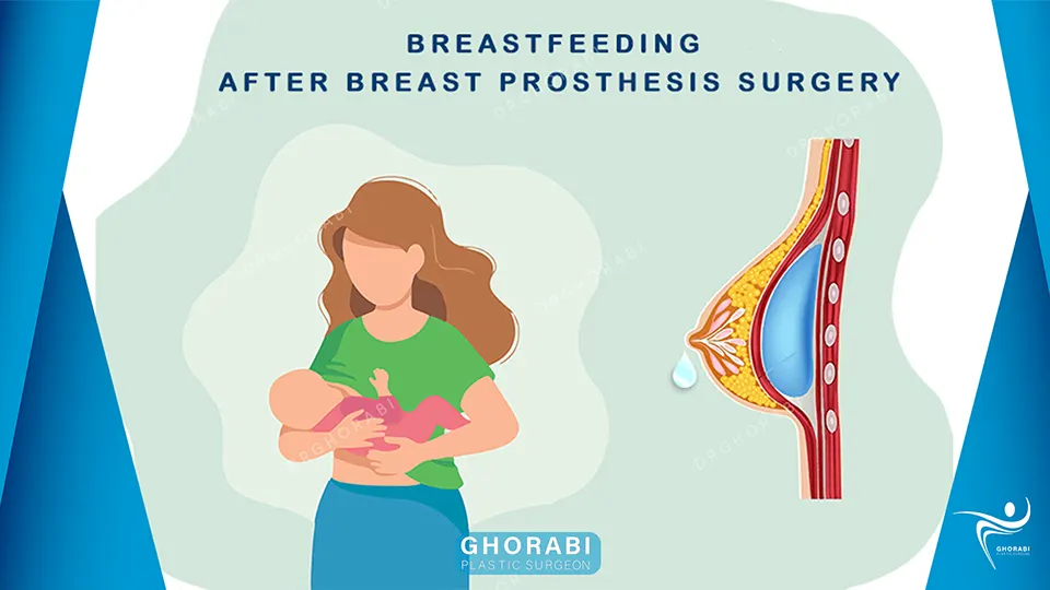 Breastfeeding after breast prosthesis surgery