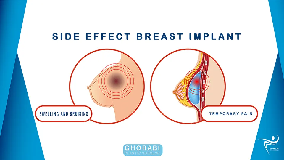 Possible risks and dangers of breast prosthesis