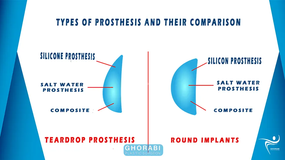 Types of breast prostheses
