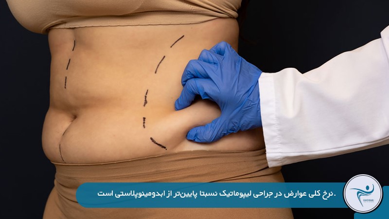 مقایسه عوارض لیپوماتیک و ابدومینوپلاستی