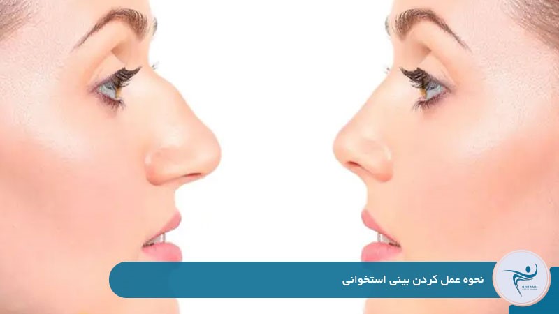 نحوه عمل كردن بينی استخوانی