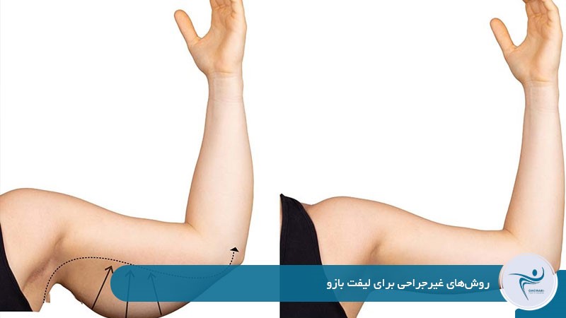 روش‌های غیرجراحی برای لیفت بازو 