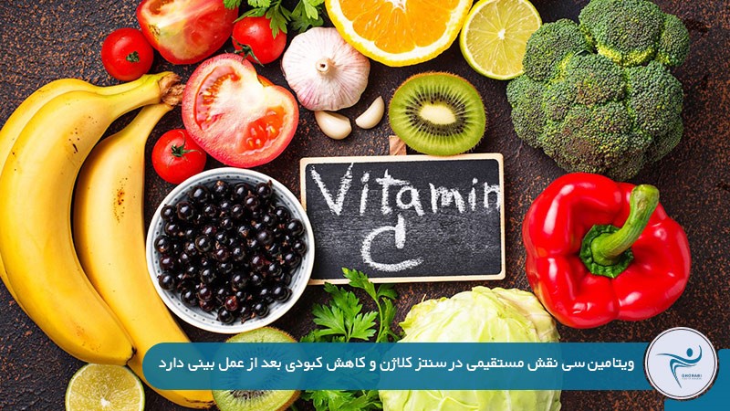 مواد غذایی سرشار از ویتامین C برای کاهش ورم بعد از عمل بینی