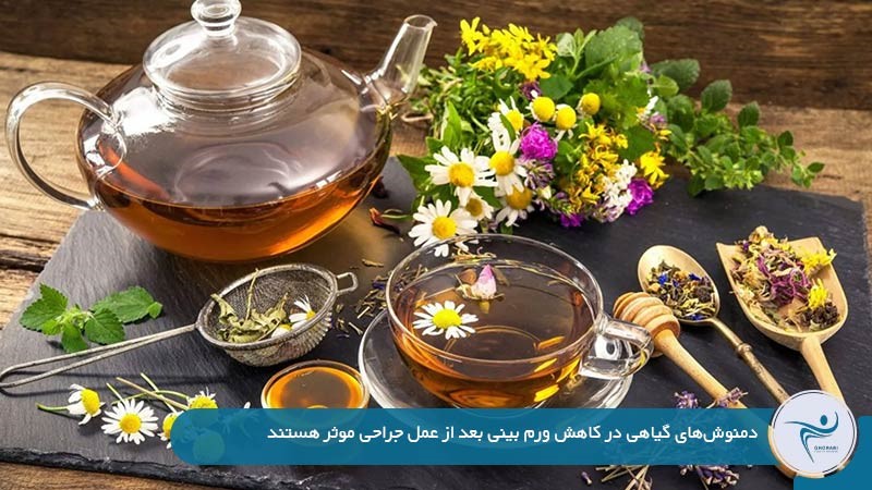 مصرف دمنوشهای گیاهی برای رفع ورم بینی بعد از عمل زیبایی
