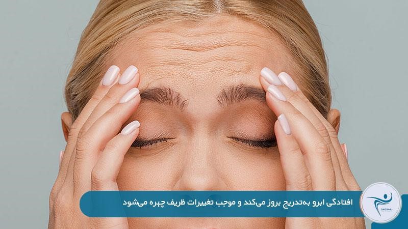 علائم افتادگی ابرو