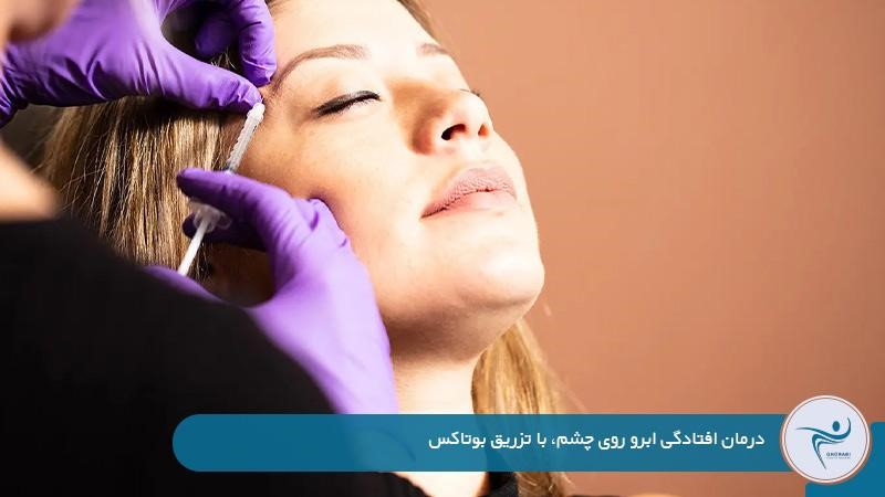 درمان افتادگی ابرو روی چشم
