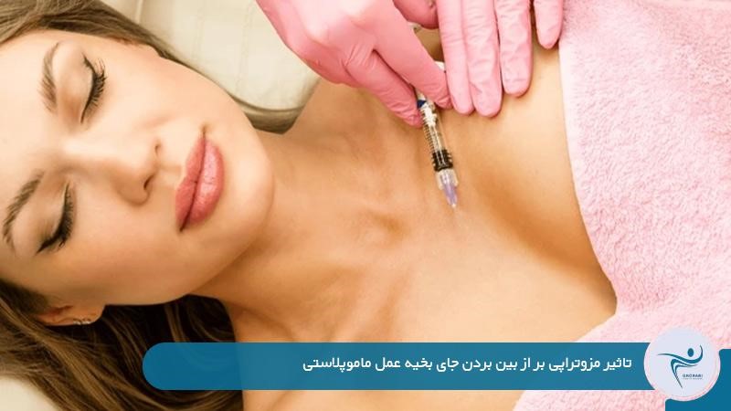 رفع جای بخیه عمل ماموپلاستی