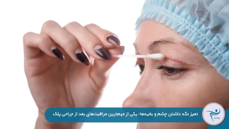 مراقبتهای بعد از جراحی پلک