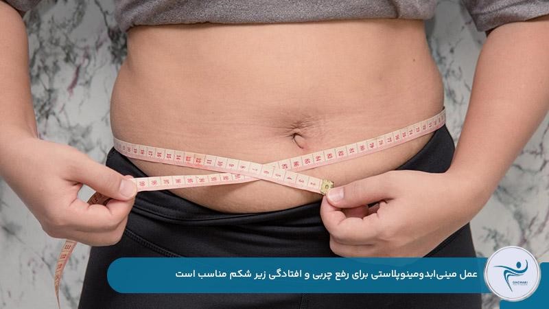عمل مینیابدومینوپلاستی برای رفع افتادگی زیر شکم