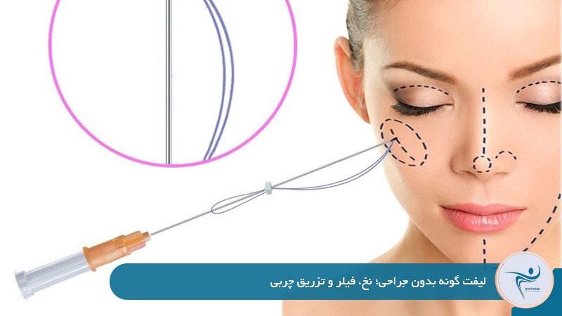 لیفت گونه بدون جراحی؛ نخ، فیلر و تزریق چربی 