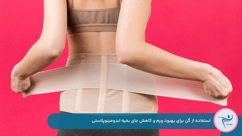 بهبود سریعتر و کمرنگ شدن جای بخیه ابدومینوپلاستی با استفاده از گن