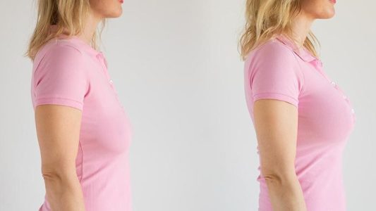 بررسی مزایا و معایب ليفت و پروتز سينه همزمان در مجله دکتر غرابی