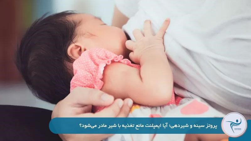 آیا بعد از عمل پروتز سينه مي توان شير داد