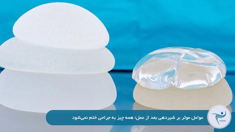 عوامل موثر بر شیردهی بعد از عمل؛ همه چیز به جراحی ختم نمیشود