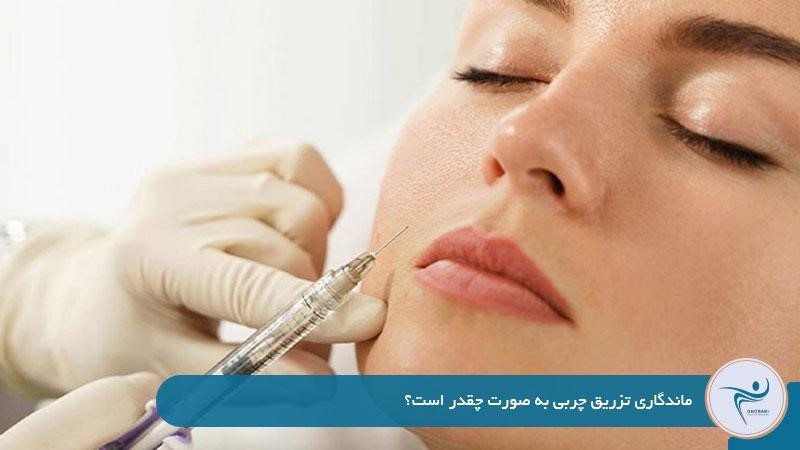 ماندگاری تزریق چربی به صورت چقدر است؟