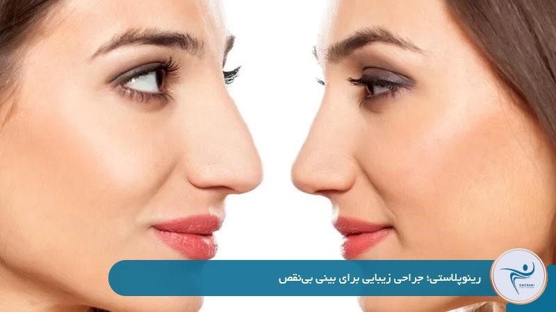 رینوپلاستی چیست