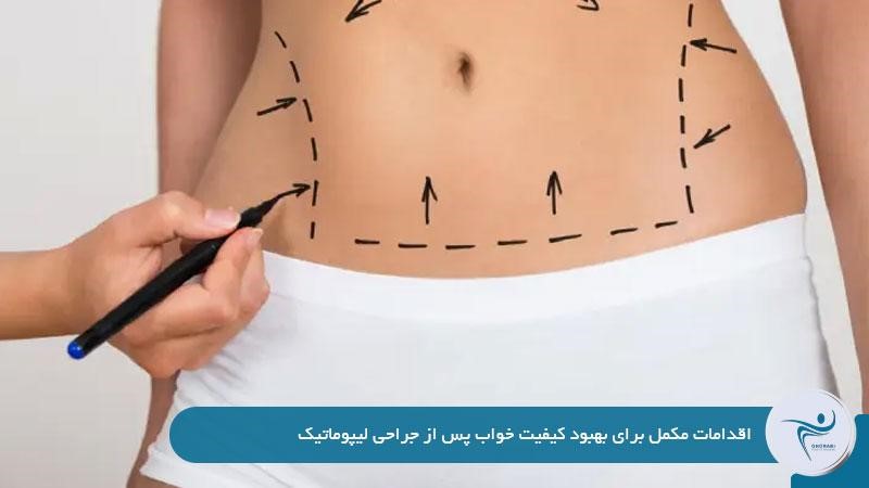 اقدامات مکمل برای بهبود کیفیت خواب پس از جراحی لیپوماتیک