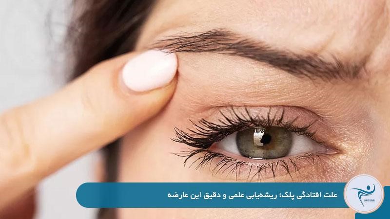علت افتادگی پلک؛ ریشهیابی علمی و دقیق این عارضه