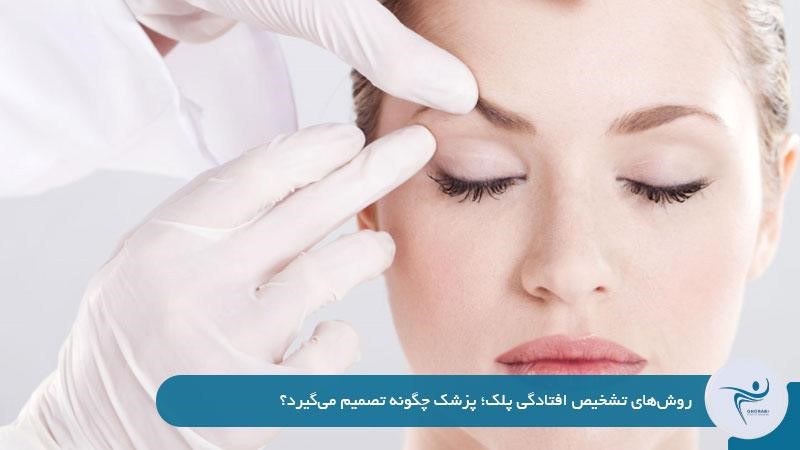 روشهای تشخیص افتادگی پلک
